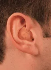 Full Shell In-the-Ear Hearing Aid