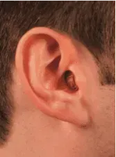 Completely-in-the-Canal Hearing Aid