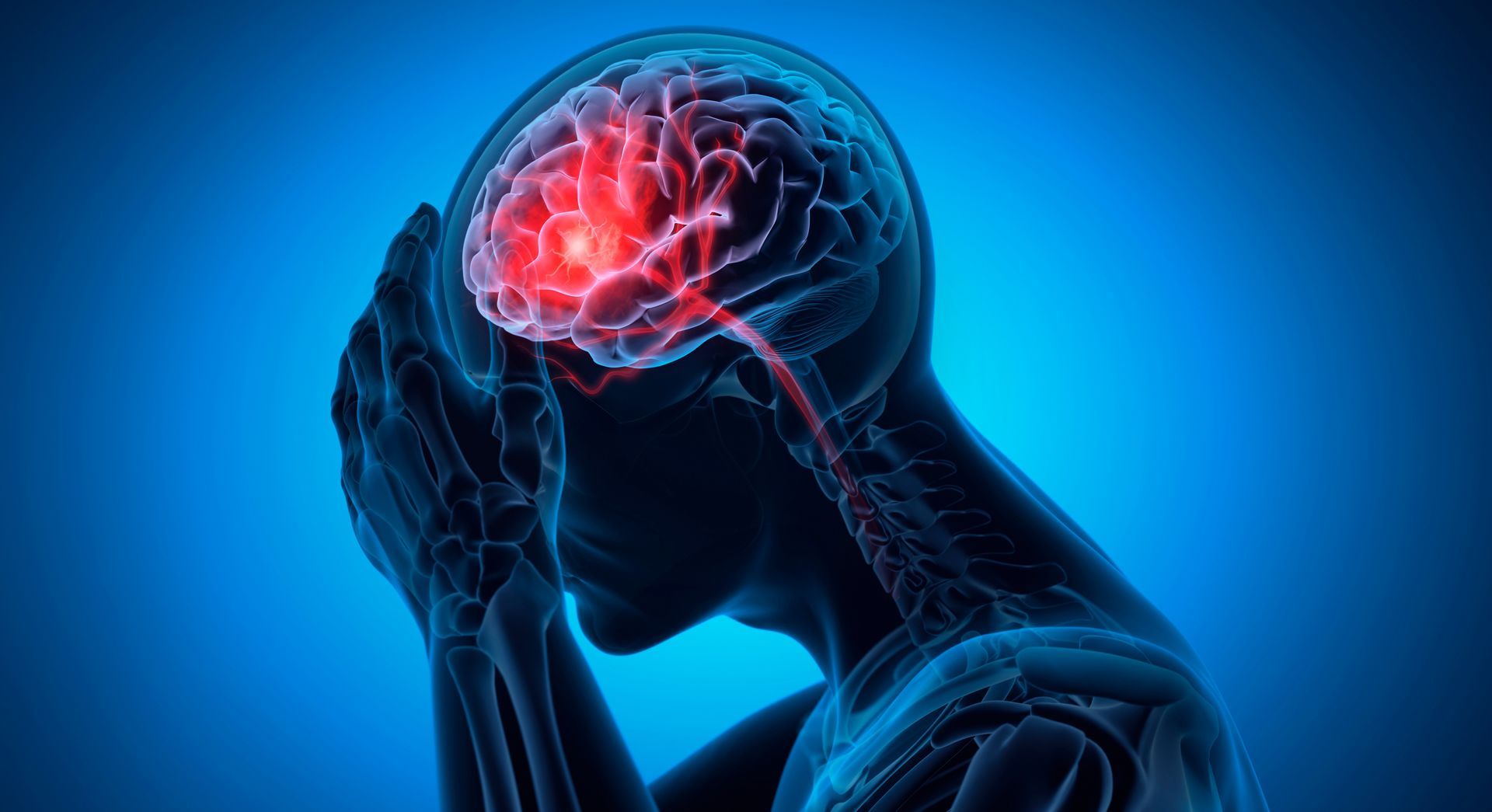 AVC (Acidente Vascular Cerebral)