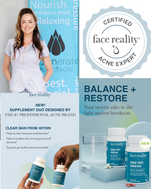 Face Reality acne care ad with woman, blue skincare bottles, and “Balance + Restore” text