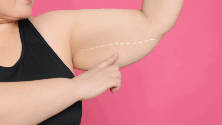 Person pinching upper arm skin against a pink background, with a dotted line marking the area.