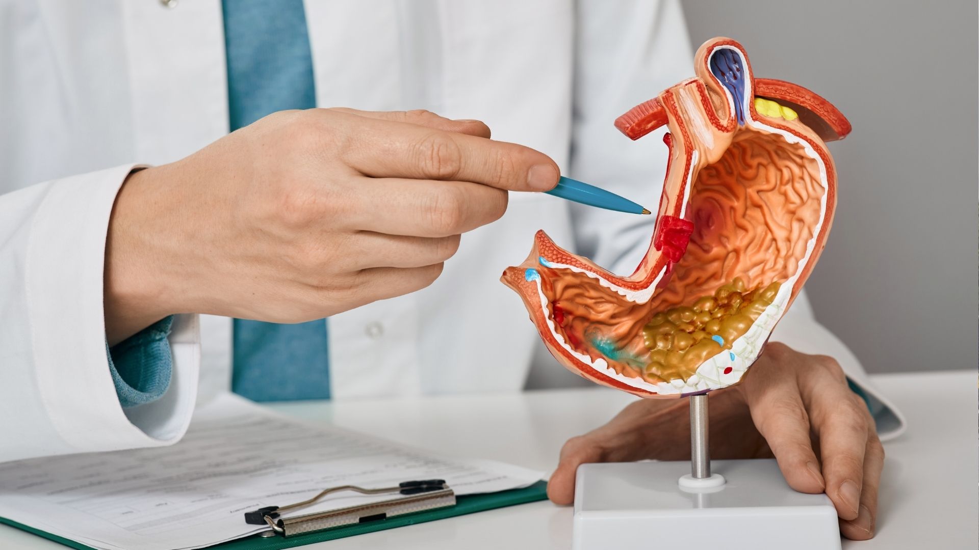Médico aponta modelo de estômago ao explicar tipos de cirurgia bariátrica