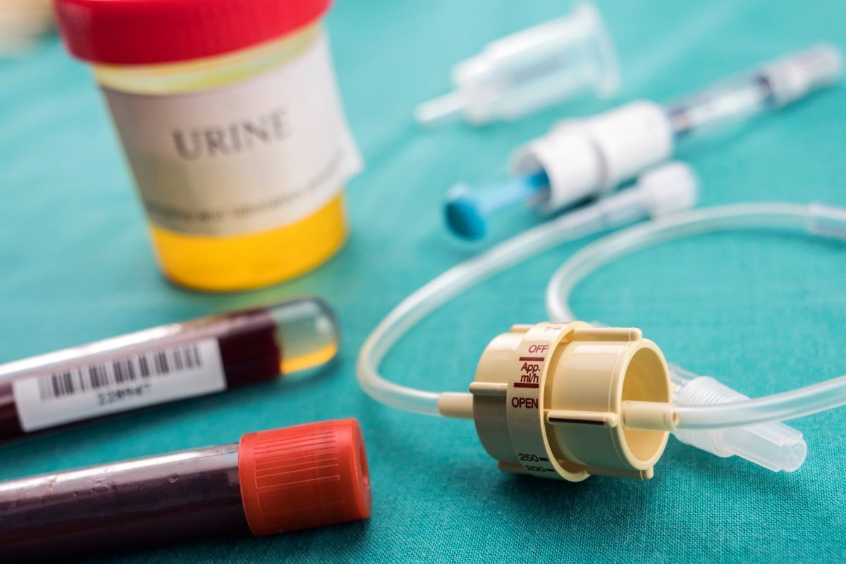 causas-sangue-no-esperma-dr-eder-rocha-urologista-picos-piaui