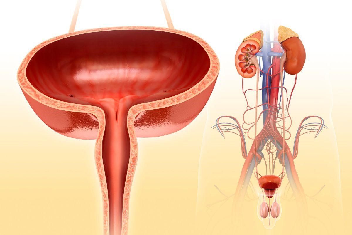 uretroplastia-quando-fazer-dr-eder-rocha-urologista-picos-piaui