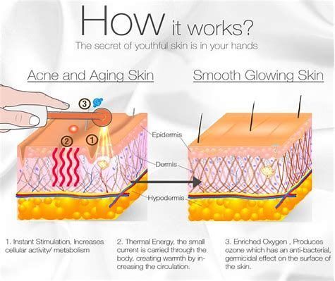 Diagram showing acne and aging skin transforming into smooth glowing skin with labeled skin layers and numbered steps
