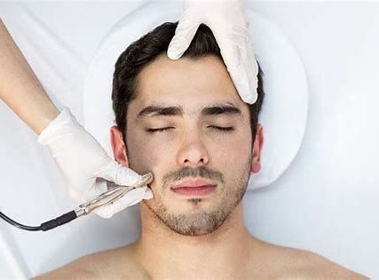 Facial treatment with a man lying down while gloved hands use a tool on his cheek