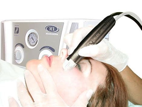 Cosmetic treatment with Medical Microdermasion machine device on a patient’s face