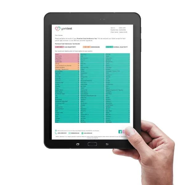 Hand holding a black tablet displaying a turquoise scheduling or calendar dashboard