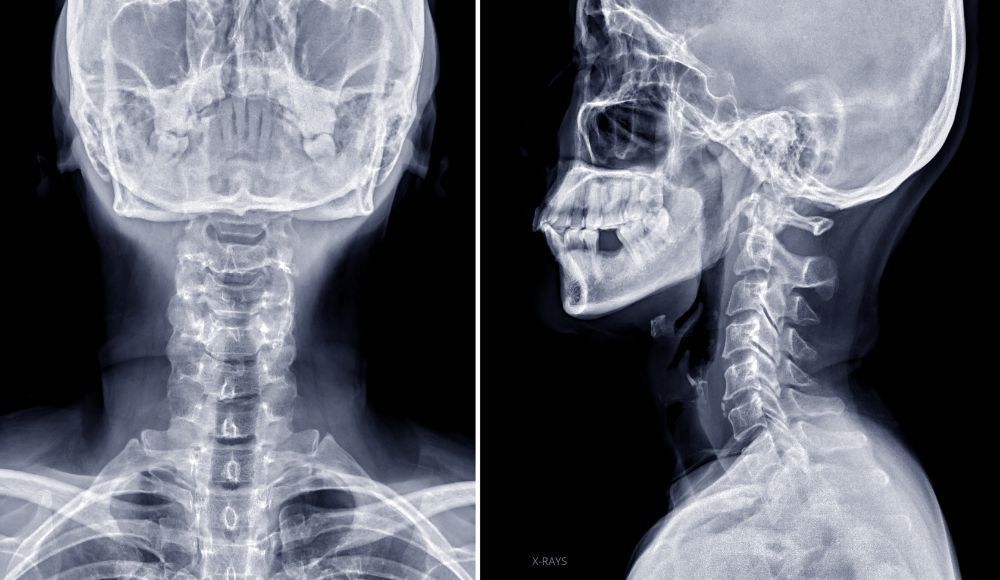 Contact us for Upper Cervical Chiropractic Care in Reading, Berks County, PA.