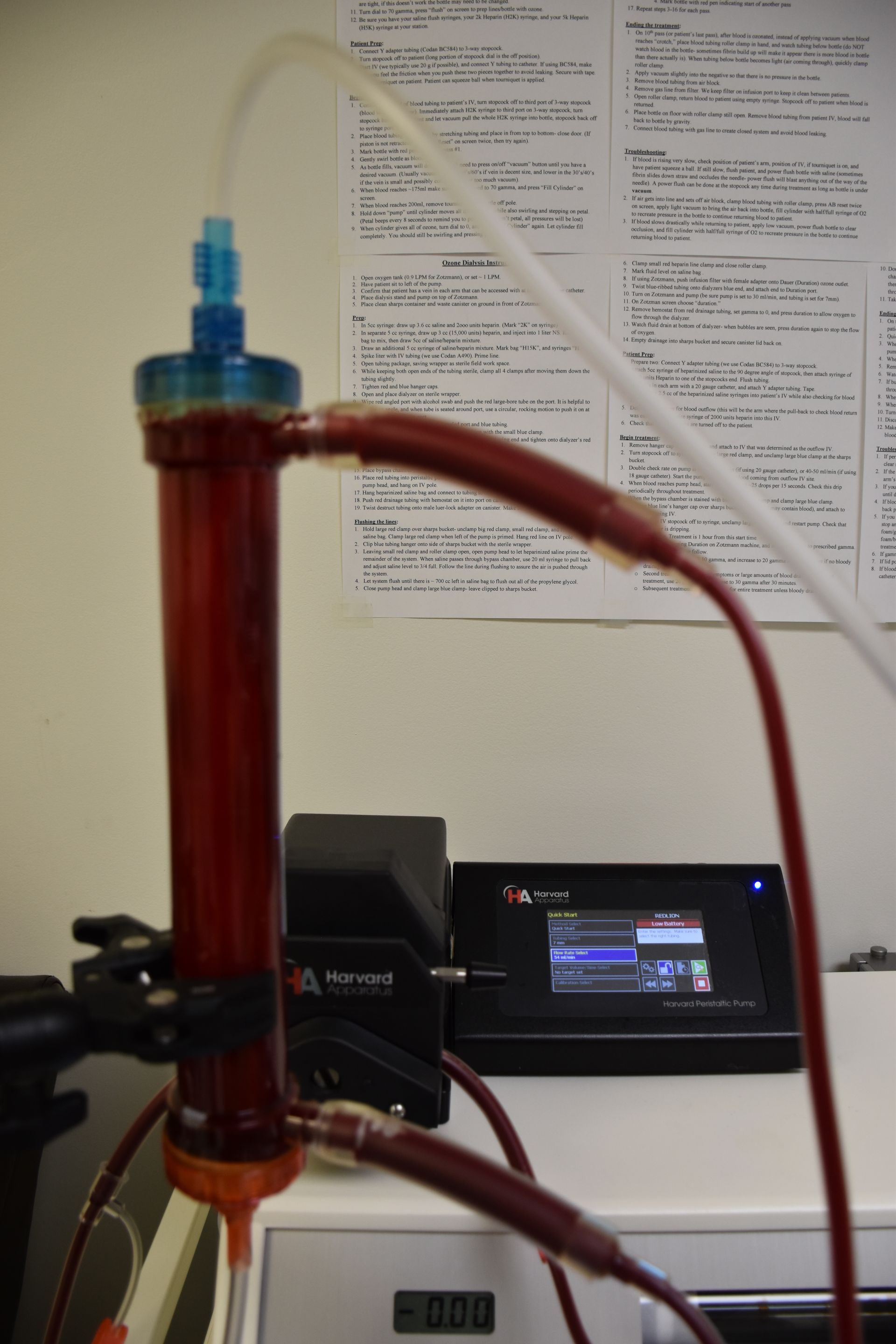 EBOO Ozone Therapy Ozone 10 Pass Therapy