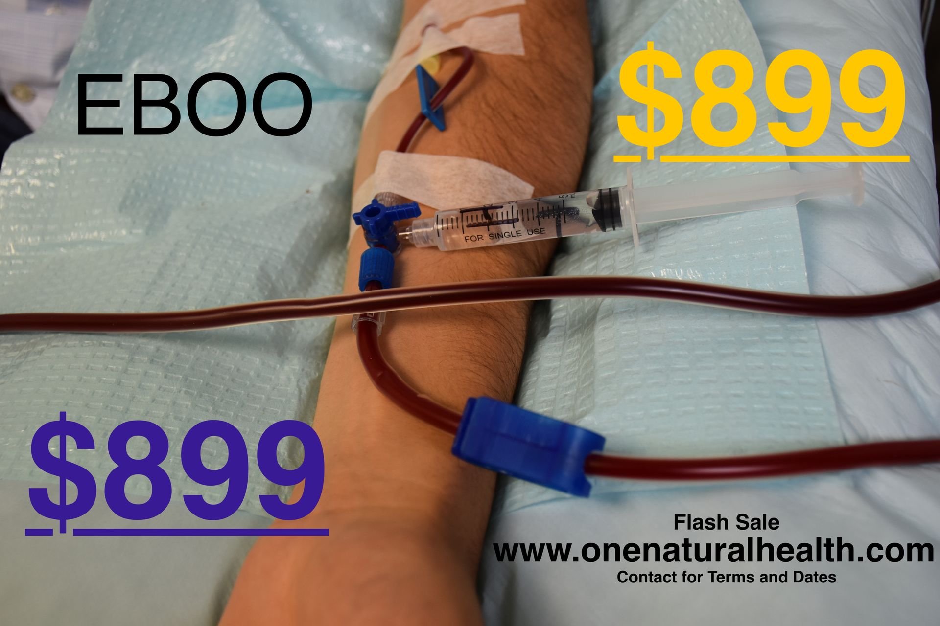 EBOO Ozone Therapy Ozone 10 Pass Therapy