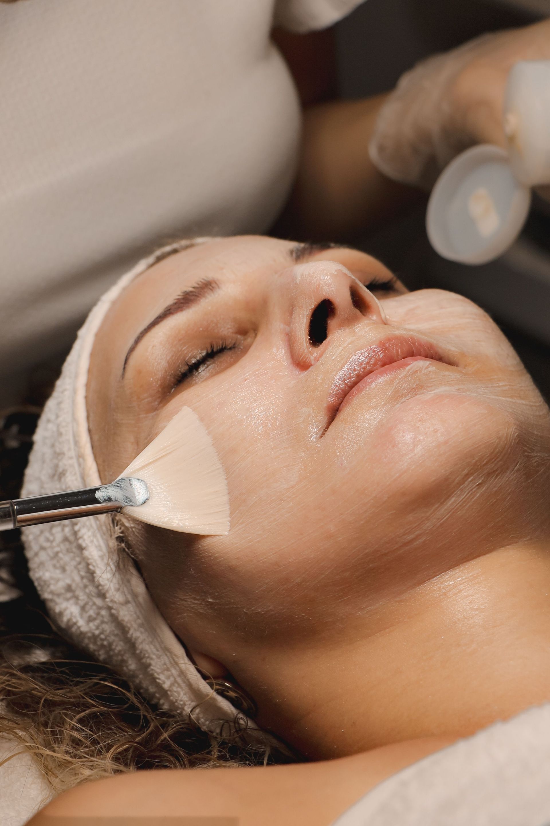 Chemical Peels