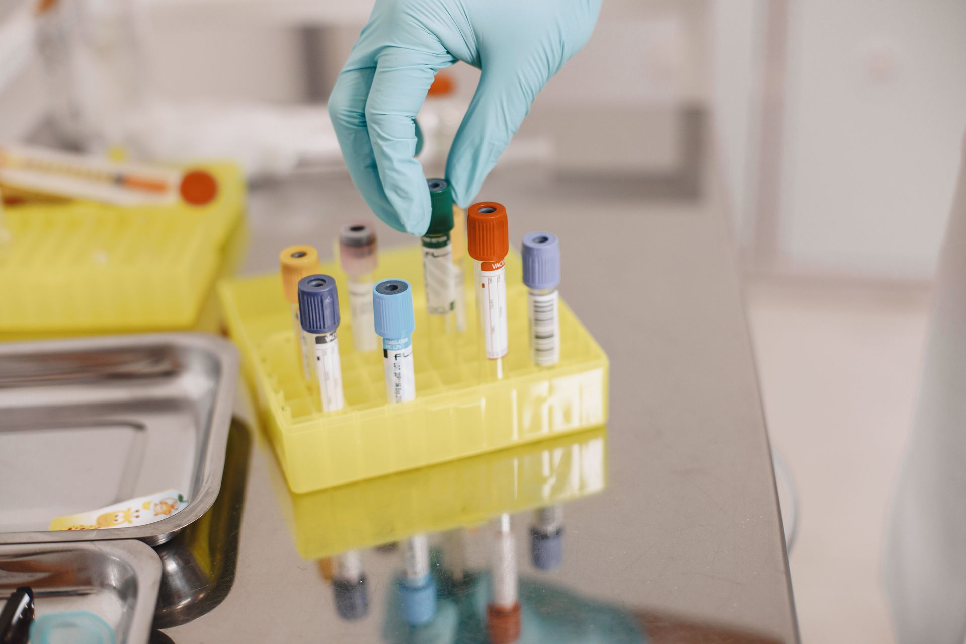 Gloved hand placing a blood sample tube in a yellow laboratory rack on a countertop
