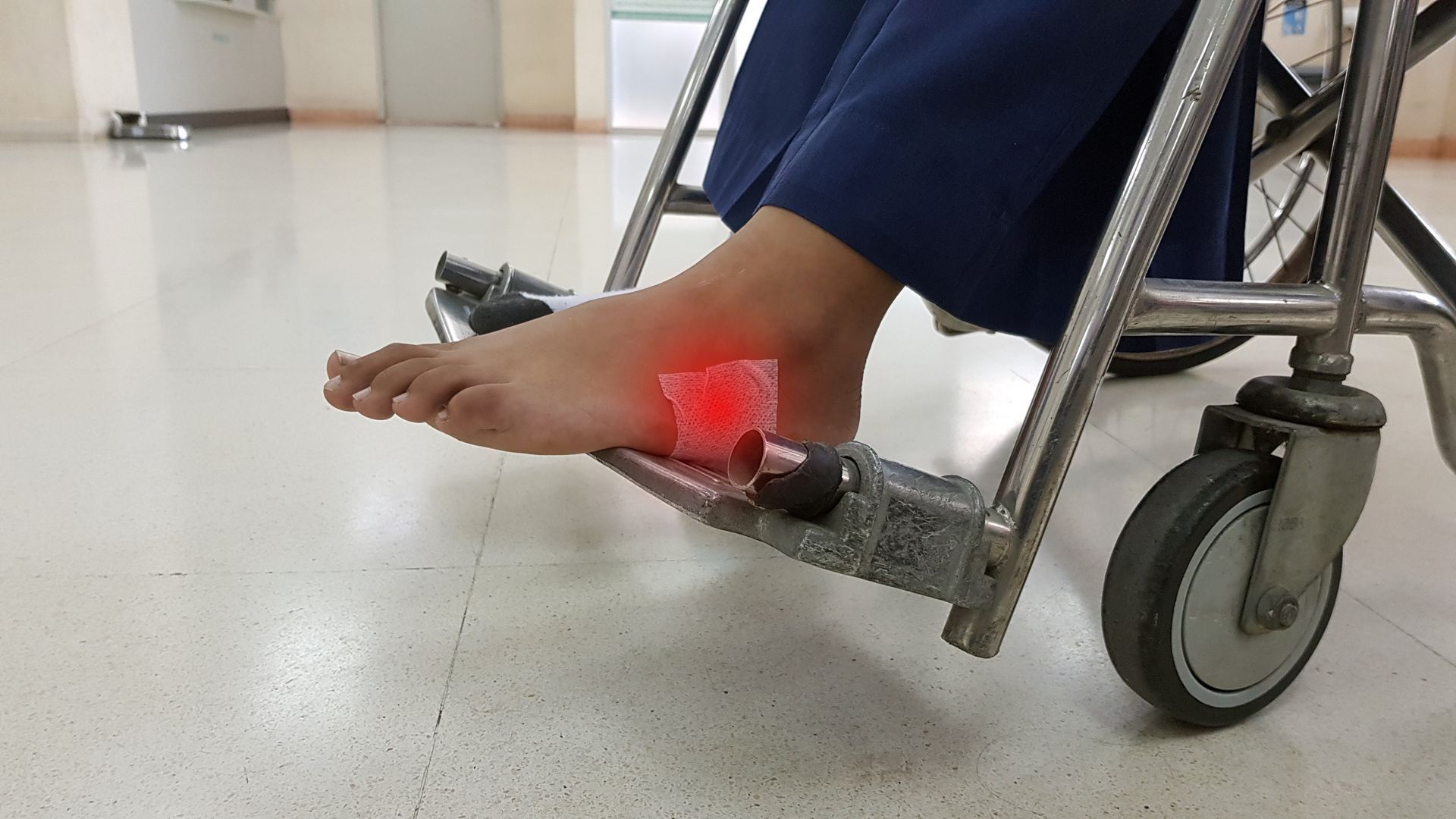 Foot Pain