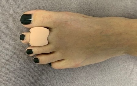 Podologie Podoloog Steunzolen Steunzool Podo Podotherapie