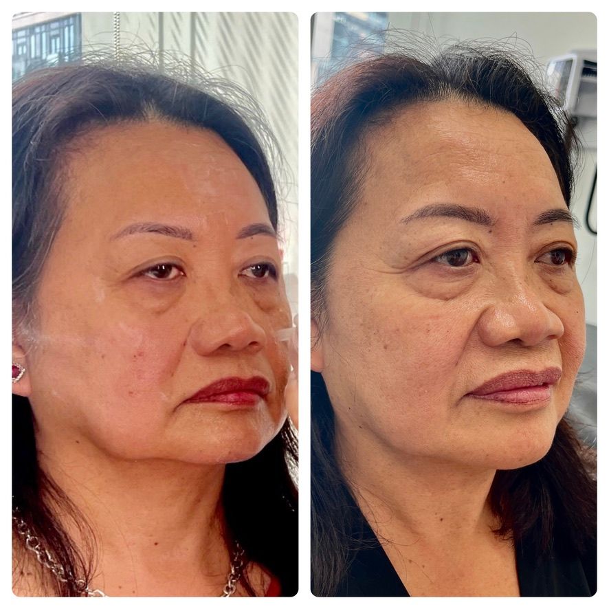 A before and after photo of a woman 's face.