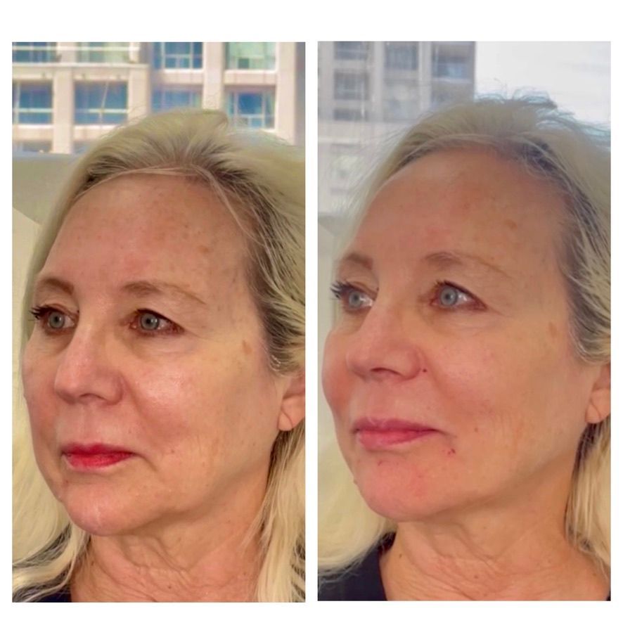 A before and after photo of a woman 's face.