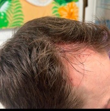 A close up of a man 's head with a painting in the background.