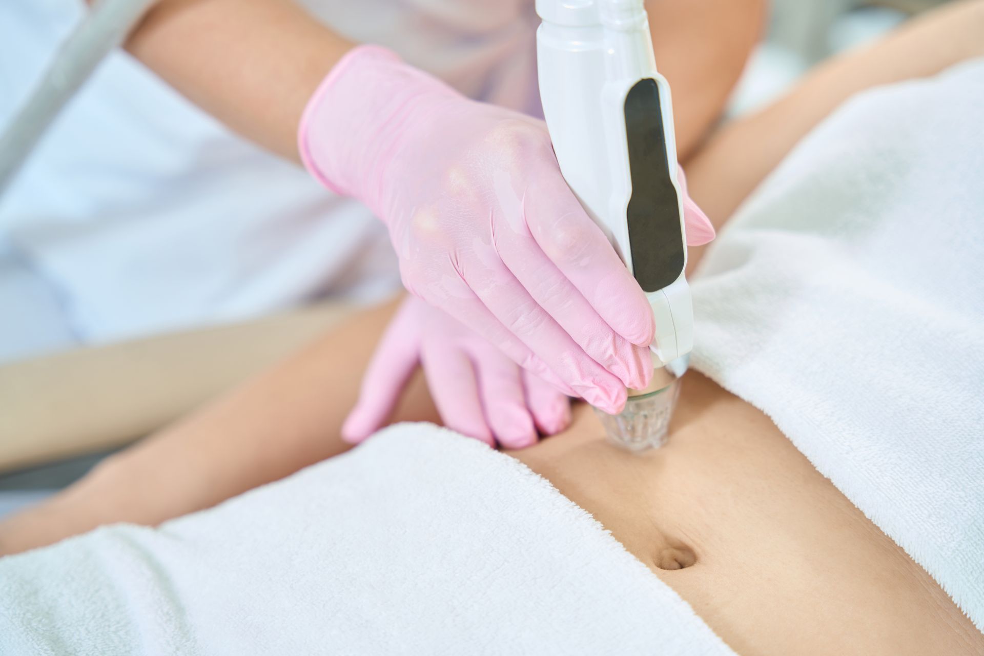 microneedling on stomach