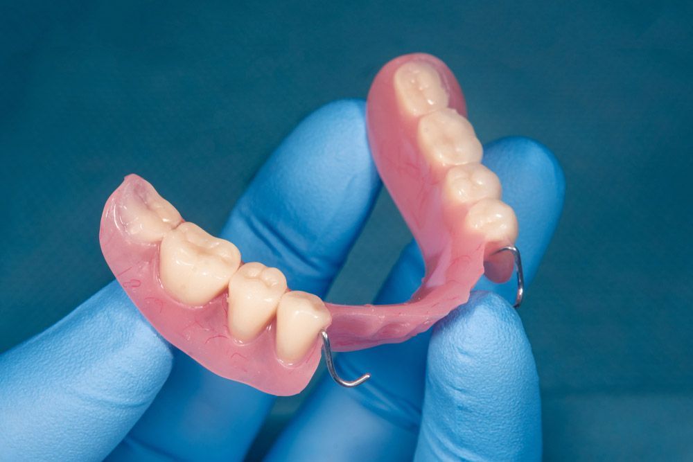 Partial denture held in a gloved hand against a blue background.