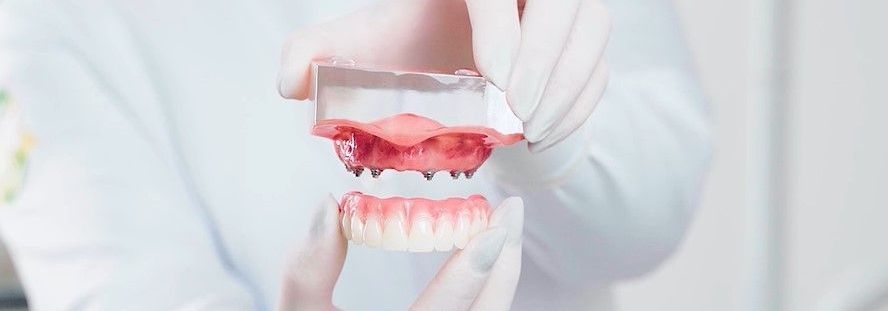 Carga Imediata: como é esse tipo de implante dentário?