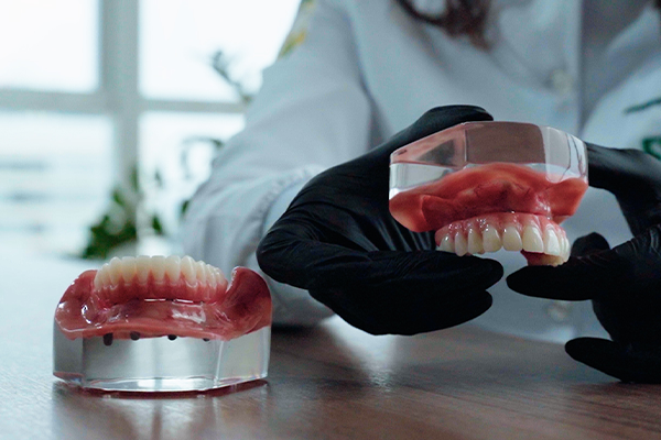 Implante dentário fixado Implantes Dentários