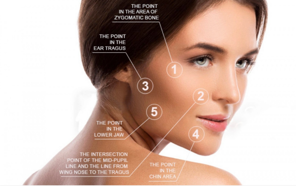 Diagram of a woman's face with numbered points illustrating areas for a procedure.