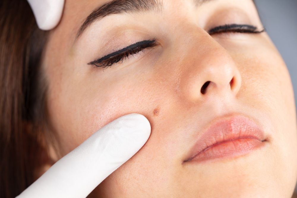 Close-up of a person’s face as a gloved finger presses a cheek, likely during a skincare treatment.