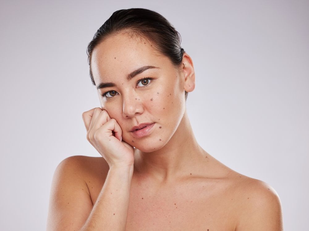 Woman with fair skin, freckles, and blue eyes; looking at the camera. Soft, natural lighting.