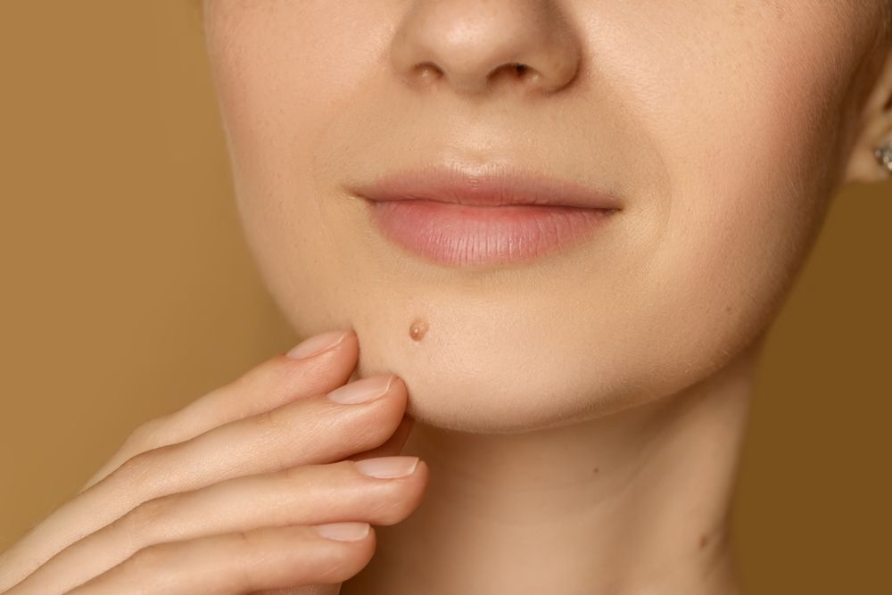 Close-up of a person’s lower face with a hand touching the chin, showing a small blemish on the skin