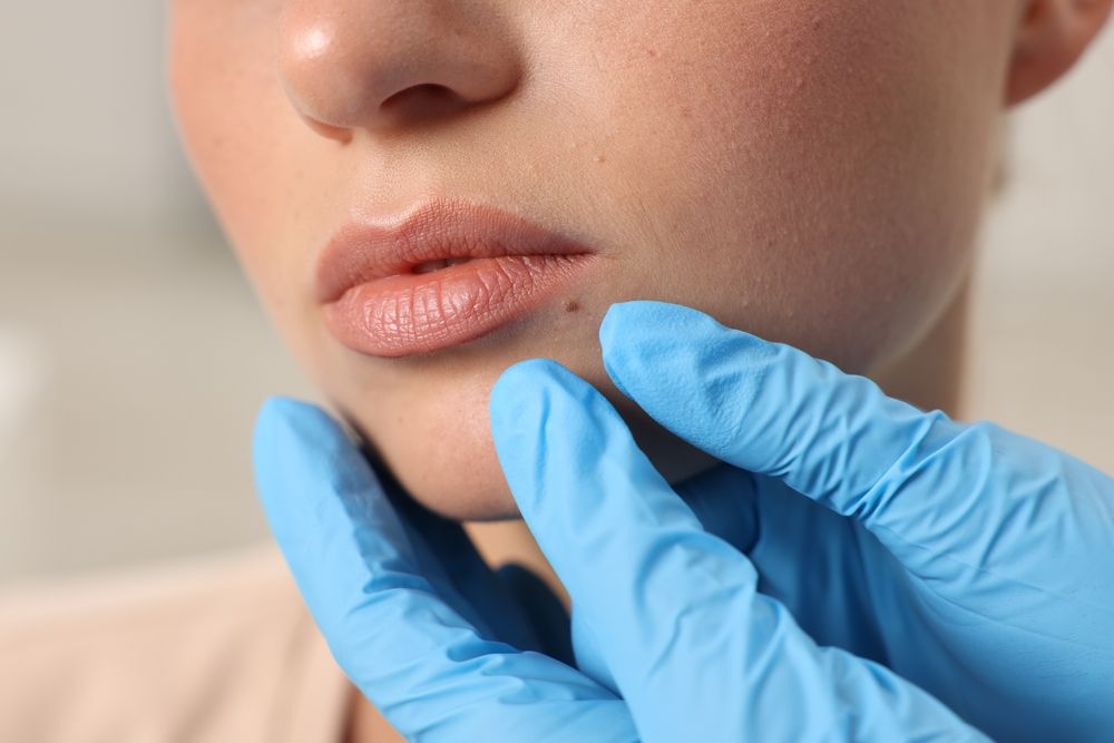 Gloved hands examining a person’s chin and lips during a facial inspection