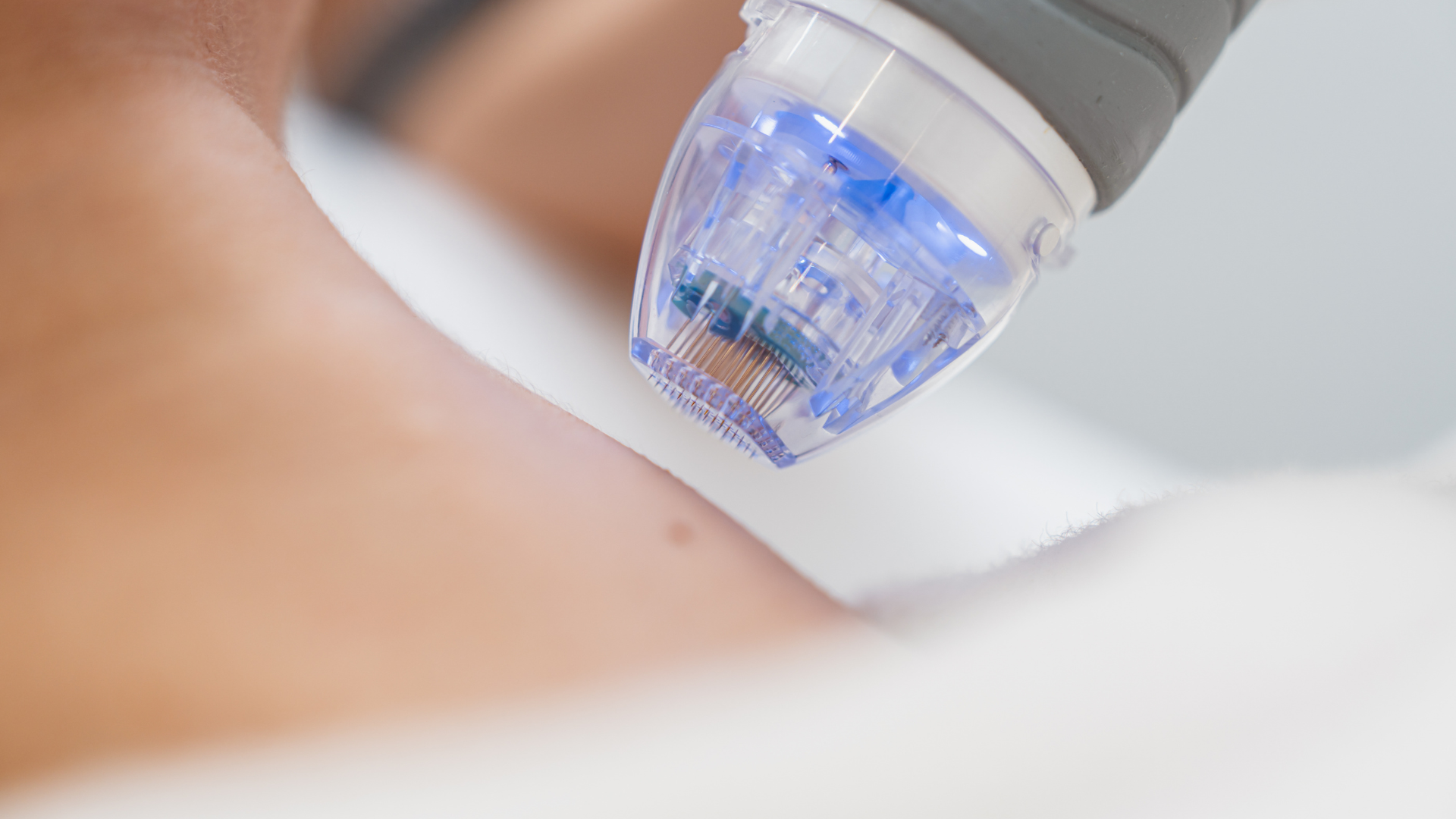 Microneedling device applied to skin, with blue-lit tip in a close-up spa treatment