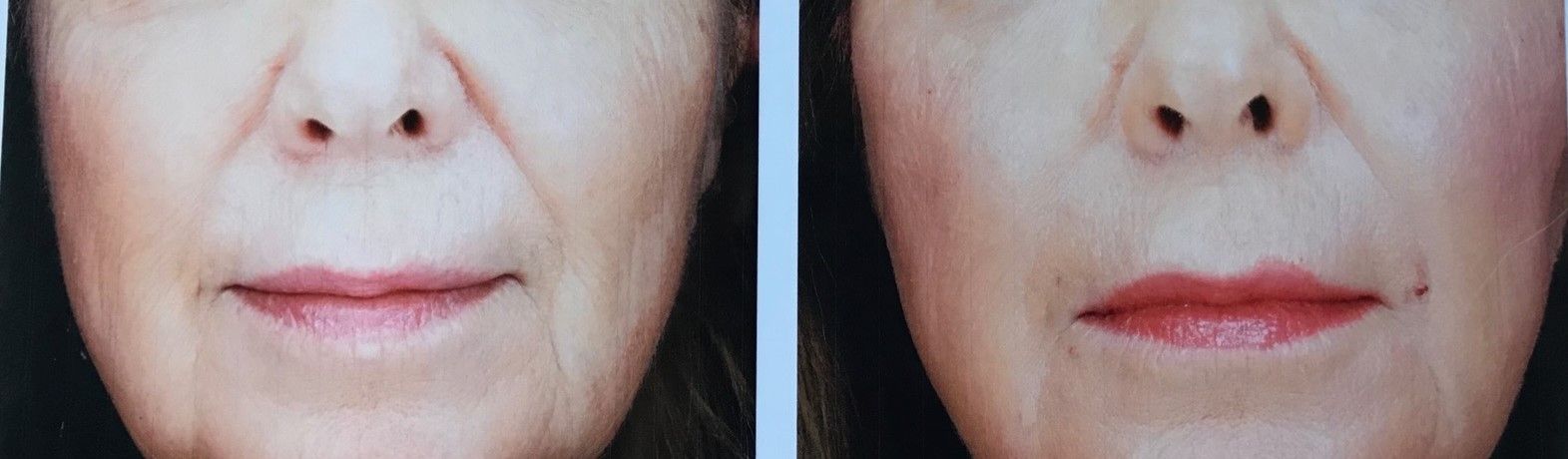 Side-by-side close-up of lower face, showing a mouth with natural lips on the left and red lipstick on the right