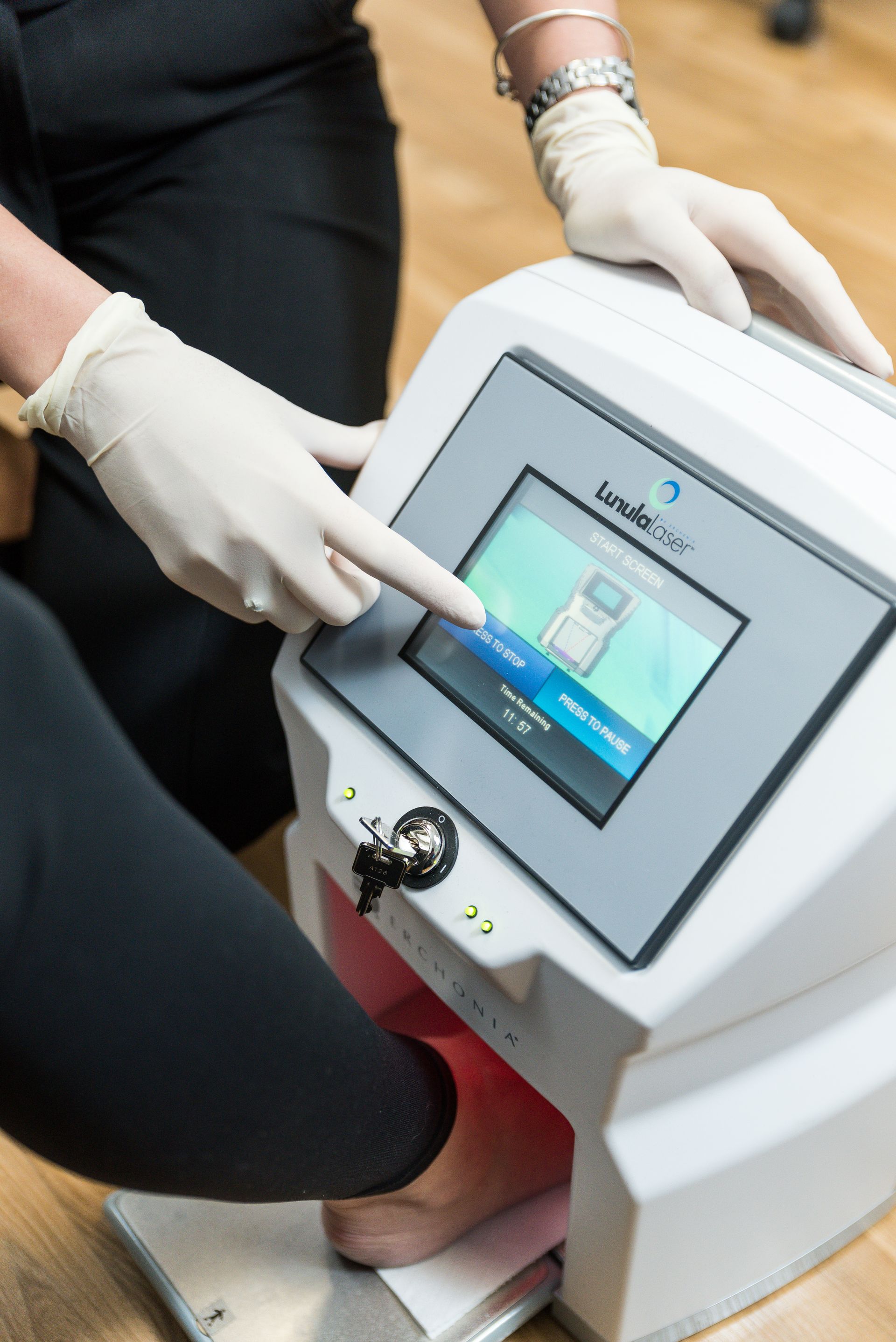 Plantar Wart Therapy Sole Focus Podiatry