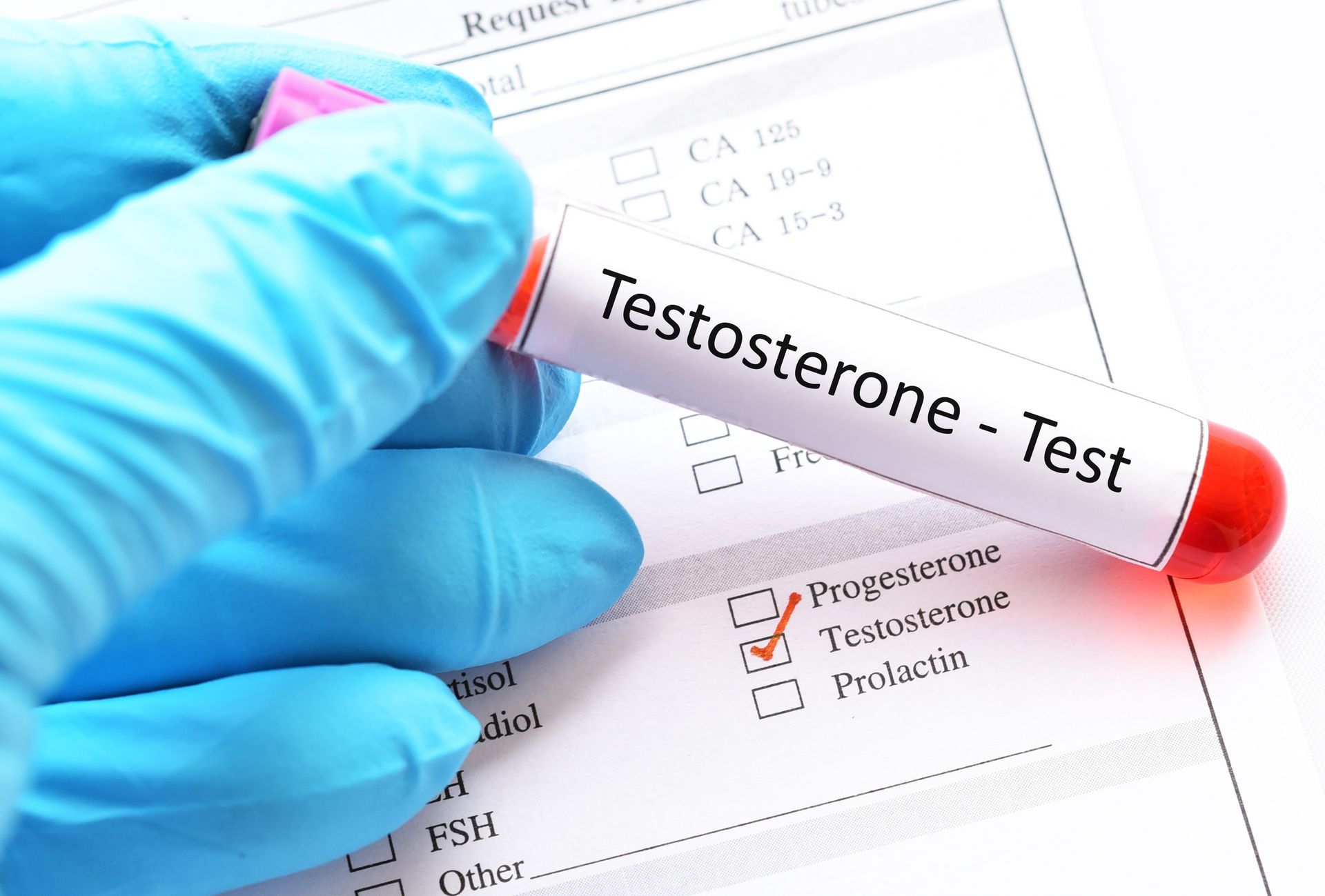 A person is holding a test tube that says testosterone test
