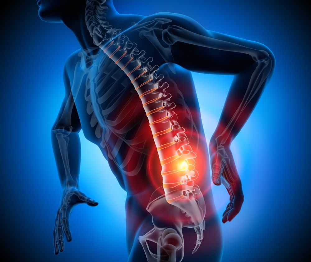 X-Ray perspective image of back pain