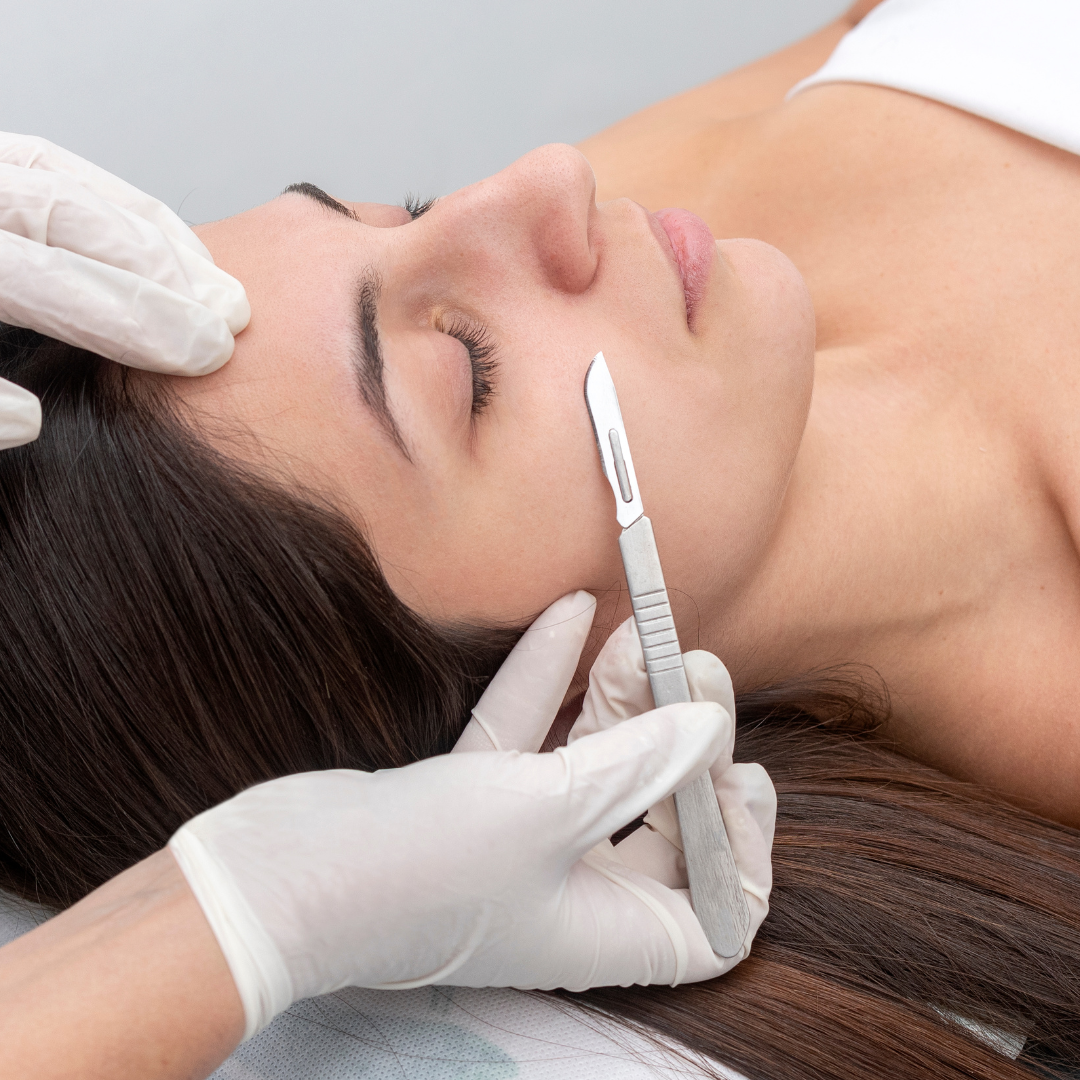 A person in gloves performs dermaplaning on a client's cheek using a sterile scalpel blade.