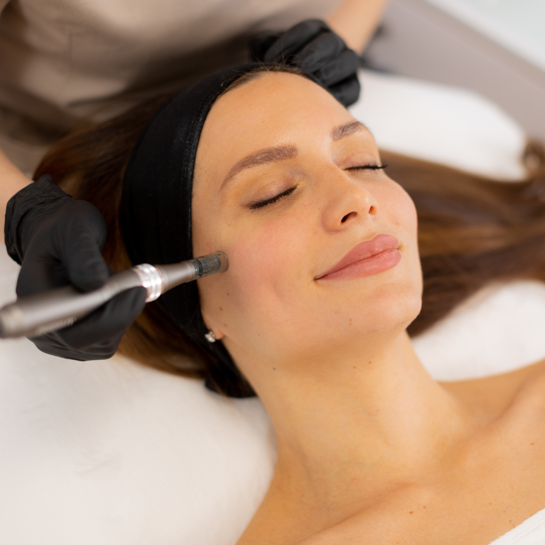 A person in a headband receives a cosmetic microneedling treatment on their cheek from a practitioner in black gloves.
