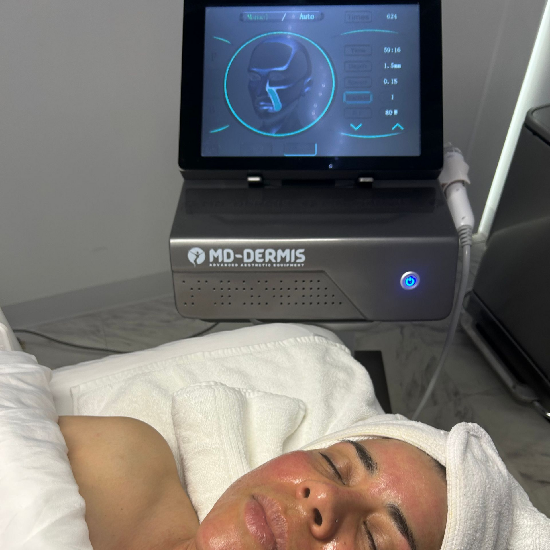 A person lying on a spa bed receiving a facial treatment with an MD-Dermis machine in a clinic setting.