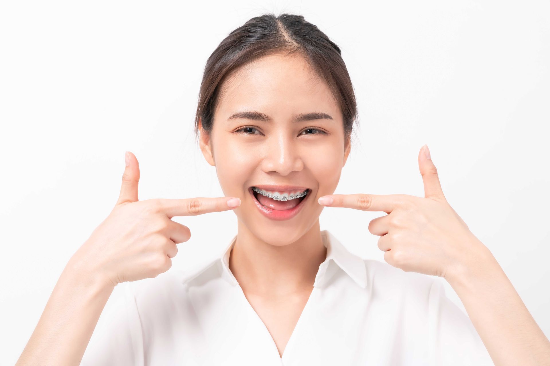 A smiling person in a white collared shirt pointing at their metal braces.