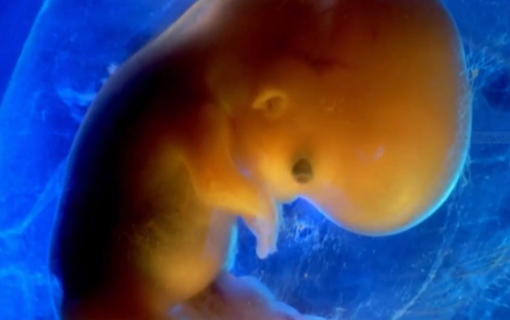 Sequence in development of human organs