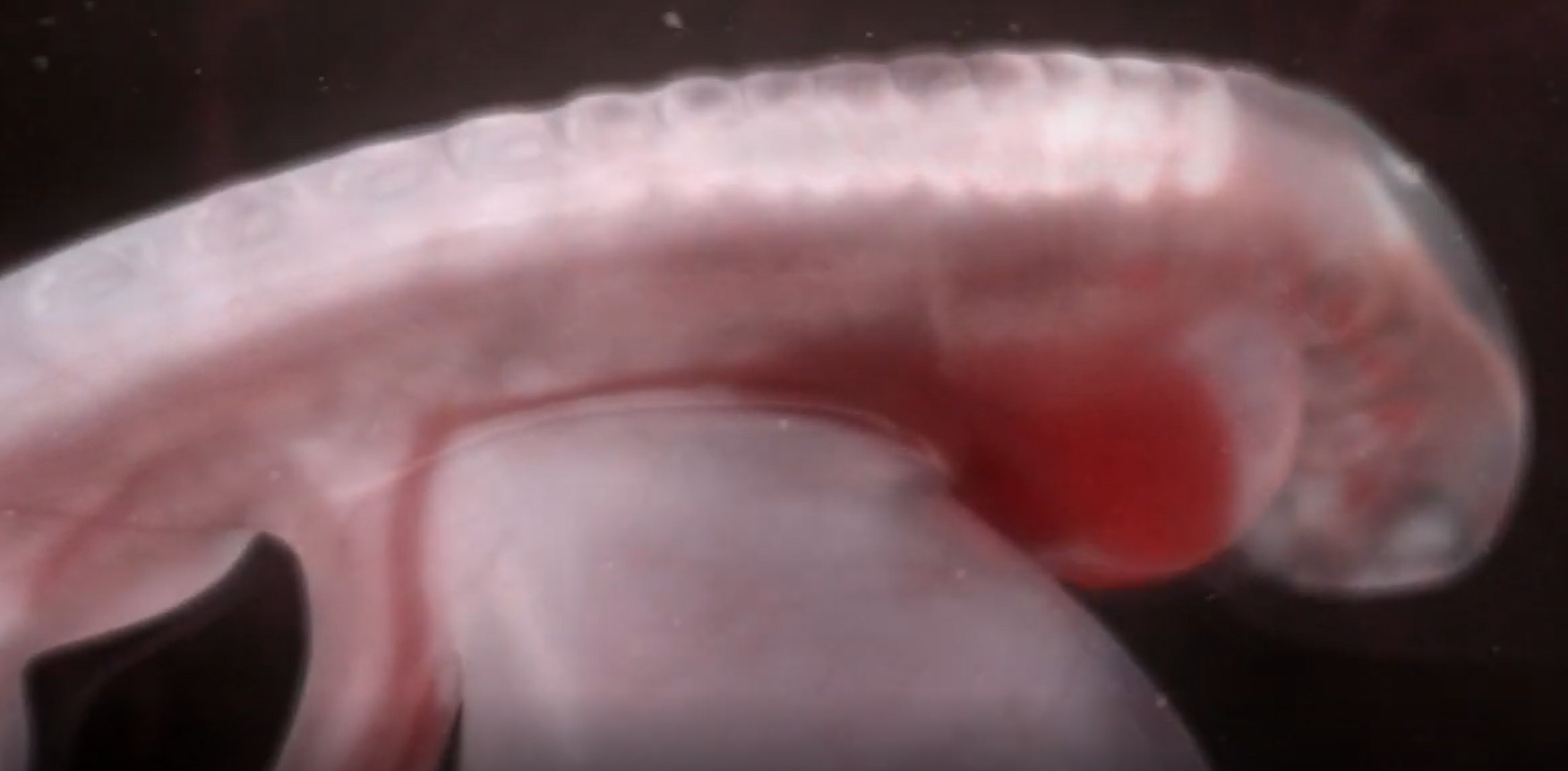 Development of embryo explained by Qur'an