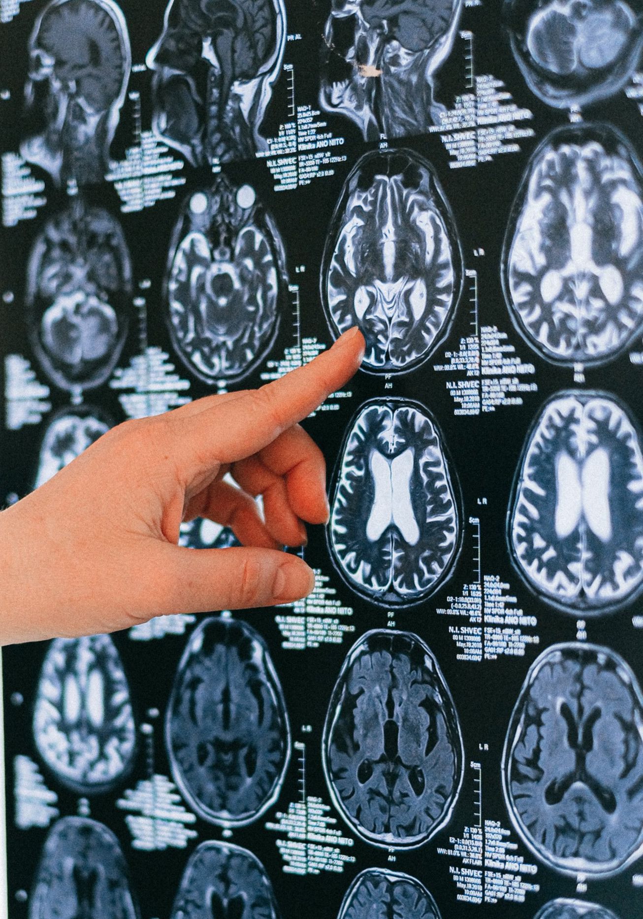 Sequence in development of human organs
