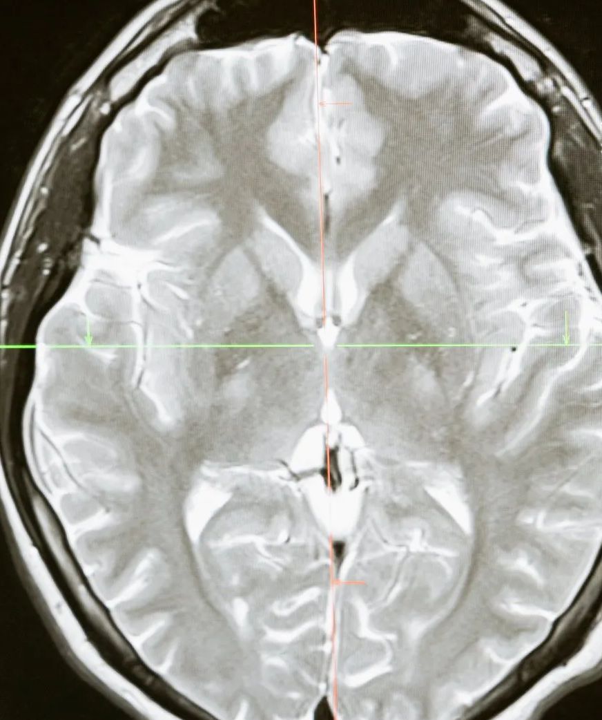Function of the frontal lobe of brain in the Qur'an