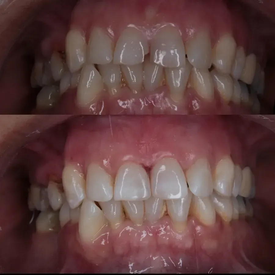 Odontología Integral y Especializada Itzel Montiel