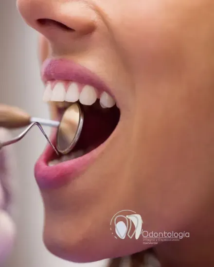 Odontología Integral y Especializada Itzel Montiel