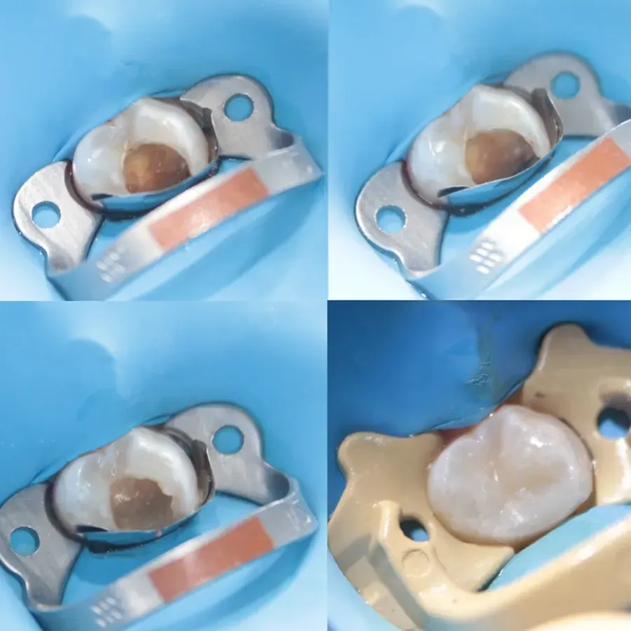 Odontología Integral y Especializada Itzel Montiel
