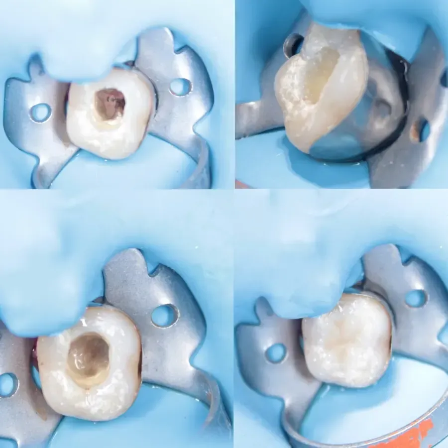 Odontología Integral y Especializada Itzel Montiel