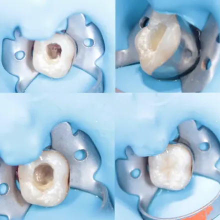 Odontología Integral y Especializada Itzel Montiel