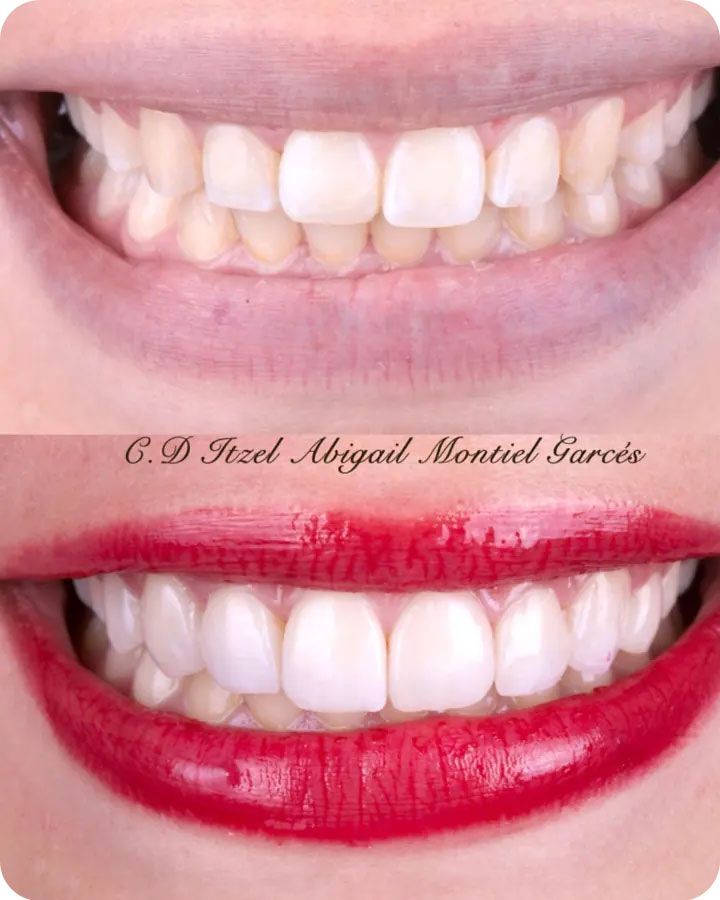 Odontología Integral y Especializada Itzel Montiel